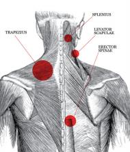 bolovi u zglobovima i vratu